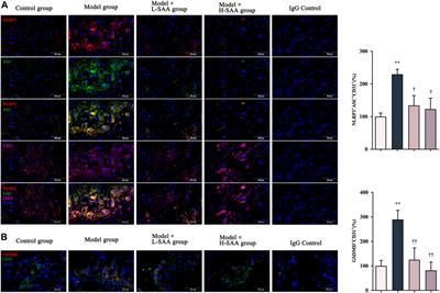 Salvianolic acid A regulates pyroptosis of endothelial cells via directly targeting PKM2 and ameliorates diabetic atherosclerosis